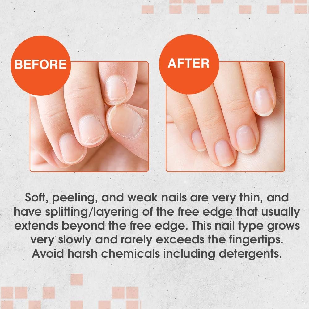 Nail Tek Intensive Therapy II 0.5 oz (2 pack)